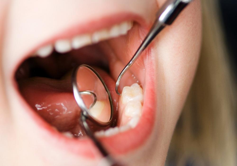 Антибиотики при лечении зубов в хирургической стоматологии